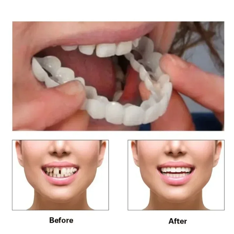 

Sdottor Perfect Fit Teeth Whitening Fake Tooth Cover Snap On Silicone Smile Veneers Teeth Upper Beauty Tool Cosmetic Teeth Free