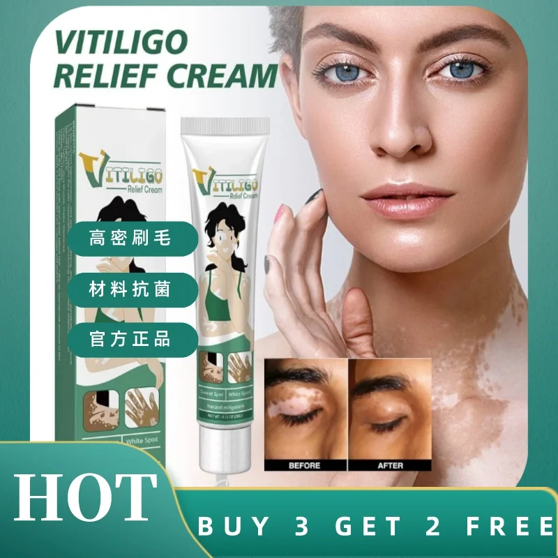 Мазь Vitiligo для удаления шкуры, гель для удаления белых пятен, устранение шкуры Vitiligo, внешняя мазь для ухода за кожей, новинка 2024
Мазь Vitiligo для удаления шкуры, гель для удаления белых пятен, устранение шкуры Vitiligo, внешняя мазь для ухода за кожей, новинка 2024