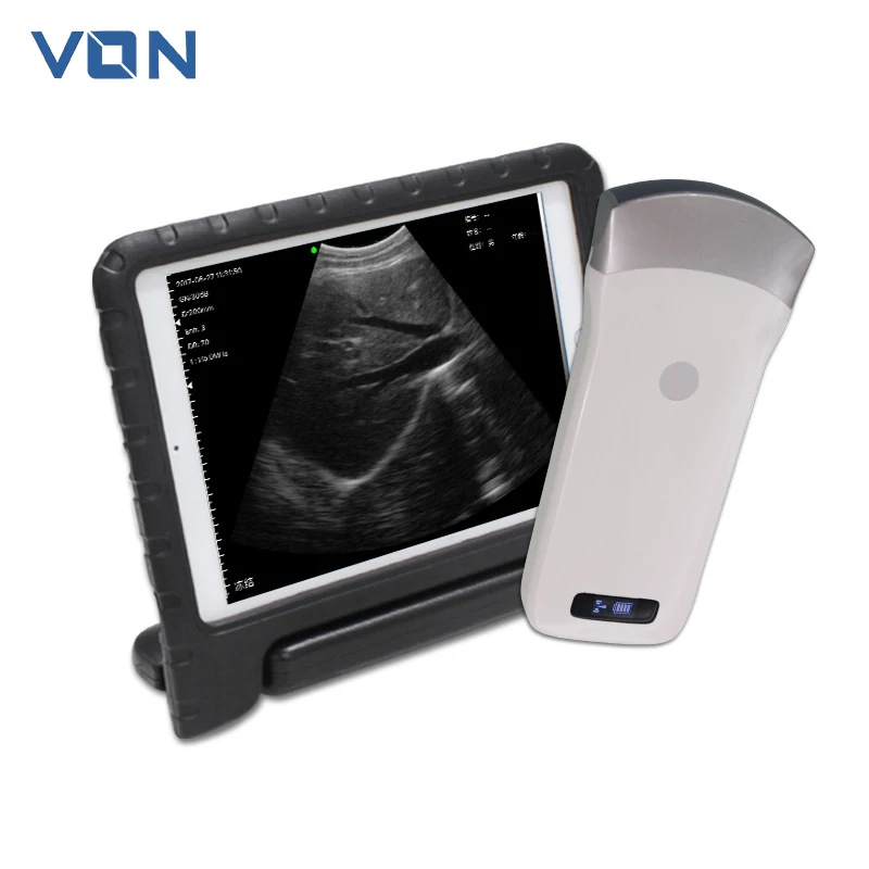 

VON Portable Ultrasound Scanner Doppler Micro Convex USB Wifi Wireless Probe Ultrasound Probes