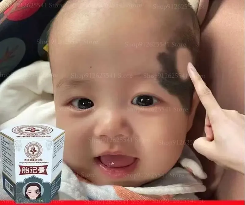 Whitening Freckles Cream Birthmark Removal Cream Facial Spots Skin Dark Spot Remover Melanin Anti-Pigmentation Improve Dullness
Whitening Freckles Cream Birthmark Removal Cream Facial Spots Skin Dark Spot Remover Melanin Anti-Pigmentation Improve Dullness
