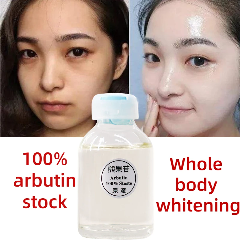 Arbutin Skin Brightening Essence Whitening Cream Remove Melanin Fade Dark Spots Body Lotion Moisturizing Lightening Skin Care
Arbutin Skin Brightening Essence Whitening Cream Remove Melanin Fade Dark Spots Body Lotion Moisturizing Lightening Skin Care
