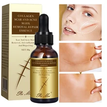 Scar Remover Serum Deep Nourishment Remove Burns Surgical Scars Repair Fade Acne Scars Moisturizing Even Skin Tone Body Care 30g
Scar Remover Serum Deep Nourishment Remove Burns Surgical Scars Repair Fade Acne Scars Moisturizing Even Skin Tone Body Care 30g