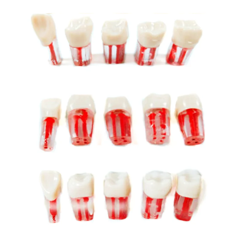 5Pcs Dental Root Canal Study Practice Model Endodontic Pulp File Molar Block
5Pcs Dental Root Canal Study Practice Model Endodontic Pulp File Molar Block