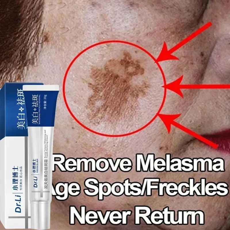 Effective Whitening Freckles Cream Remove Melasma Dark Spots Fade Pigmentation Moisturize Brighten Face Skin Care Product
Effective Whitening Freckles Cream Remove Melasma Dark Spots Fade Pigmentation Moisturize Brighten Face Skin Care Product