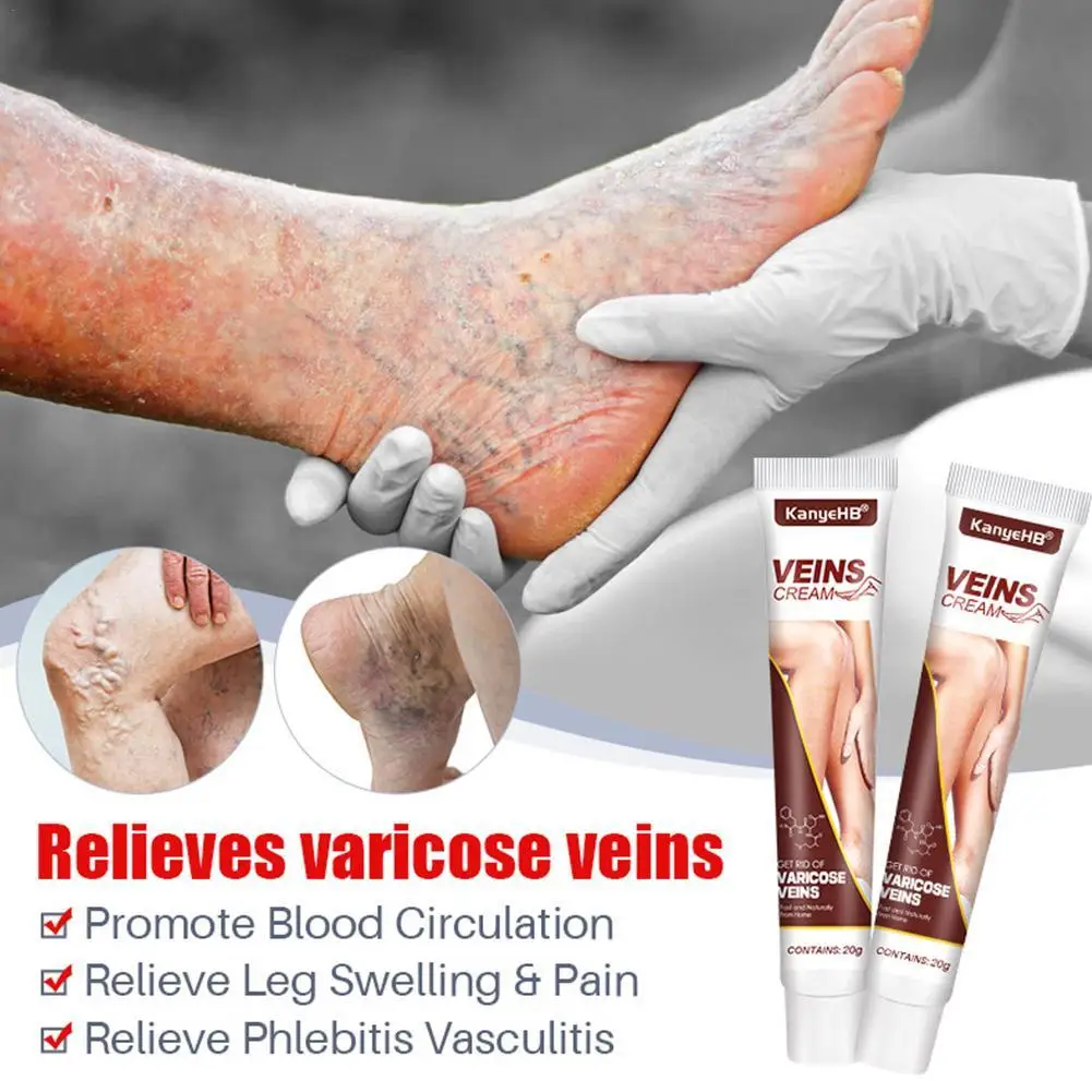 

Effective Varicose Vein Relief Cream Ointment For Varicose Veins To Relieve Vasculitis Phlebitis Spider Pain Treatment