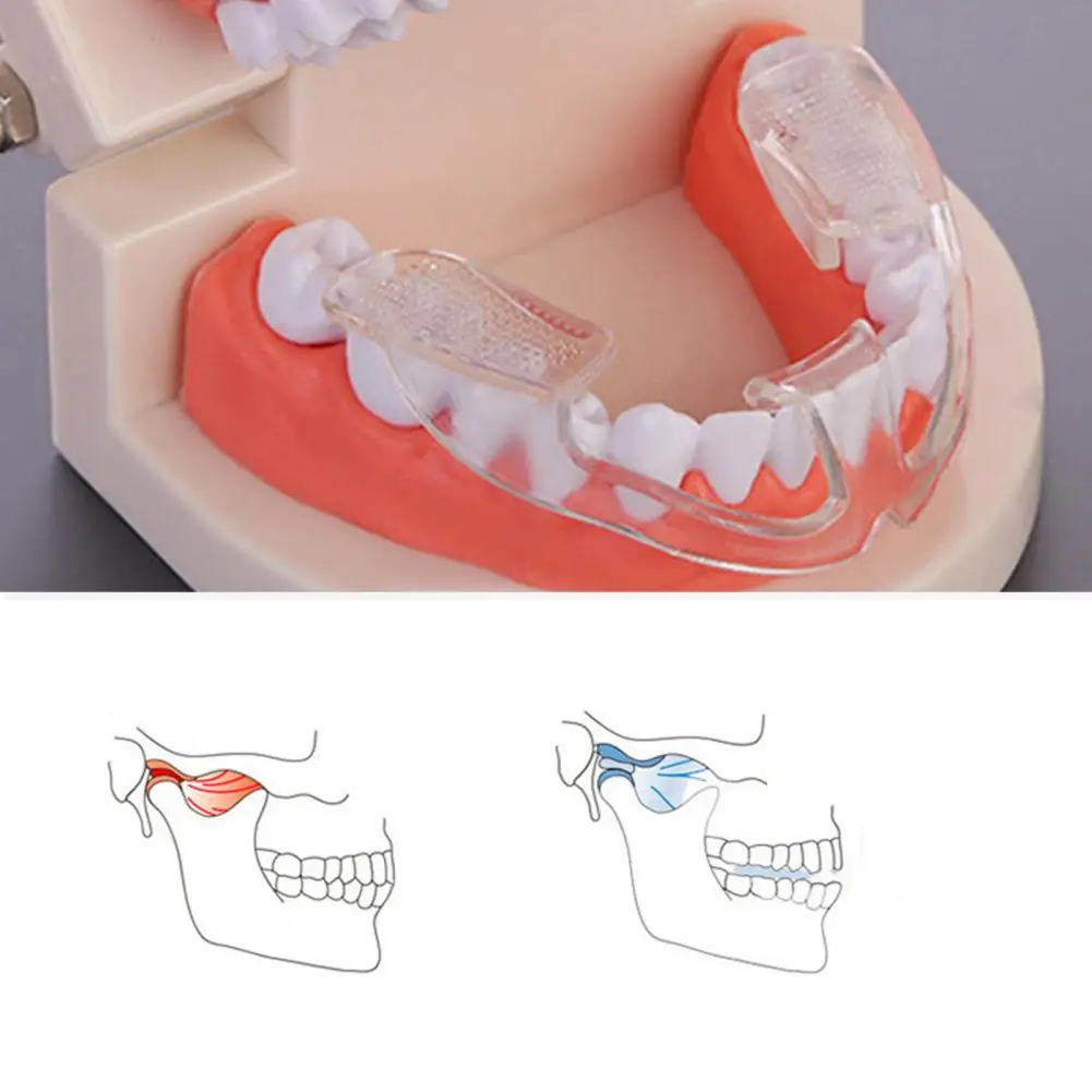 Sleep Teeth Guard Safe Silicone Material Teeth Guardian Simple Operation Tooth Braces
Sleep Teeth Guard Safe Silicone Material Teeth Guardian Simple Operation Tooth Braces