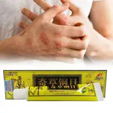 

Advanced Body Psoriasis Cream For Dermatitis And Eczema Pruritus Psoriasis Ointment Herbal Creams M3h1