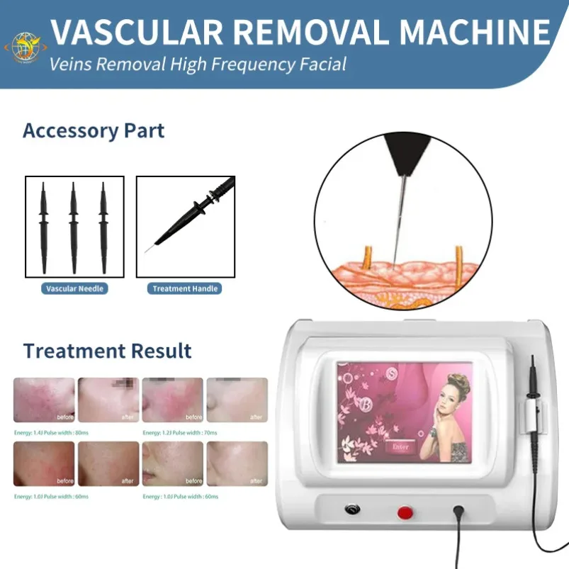 

Rbs R-F E Spider Vein Removal High Frequency Vascular Removal Physiotherapy Machine R-F Laser Beauty Equipment