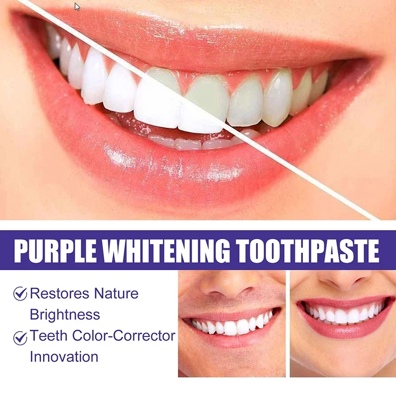 

Sdatter Teeth Cleansing Whitening Toothpaste Removes Stains Colour Corrector Repair Bleaching Tools Fresh Breath Beauty Health C