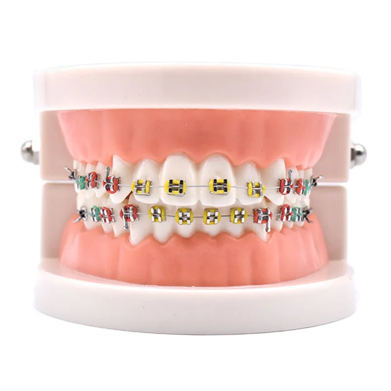 Dental Materials Orthodontic Correction Model Standard Metal Oral Dental Bracket Model Dental Tools Dentist Lab Denture Model
Dental Materials Orthodontic Correction Model Standard Metal Oral Dental Bracket Model Dental Tools Dentist Lab Denture Model