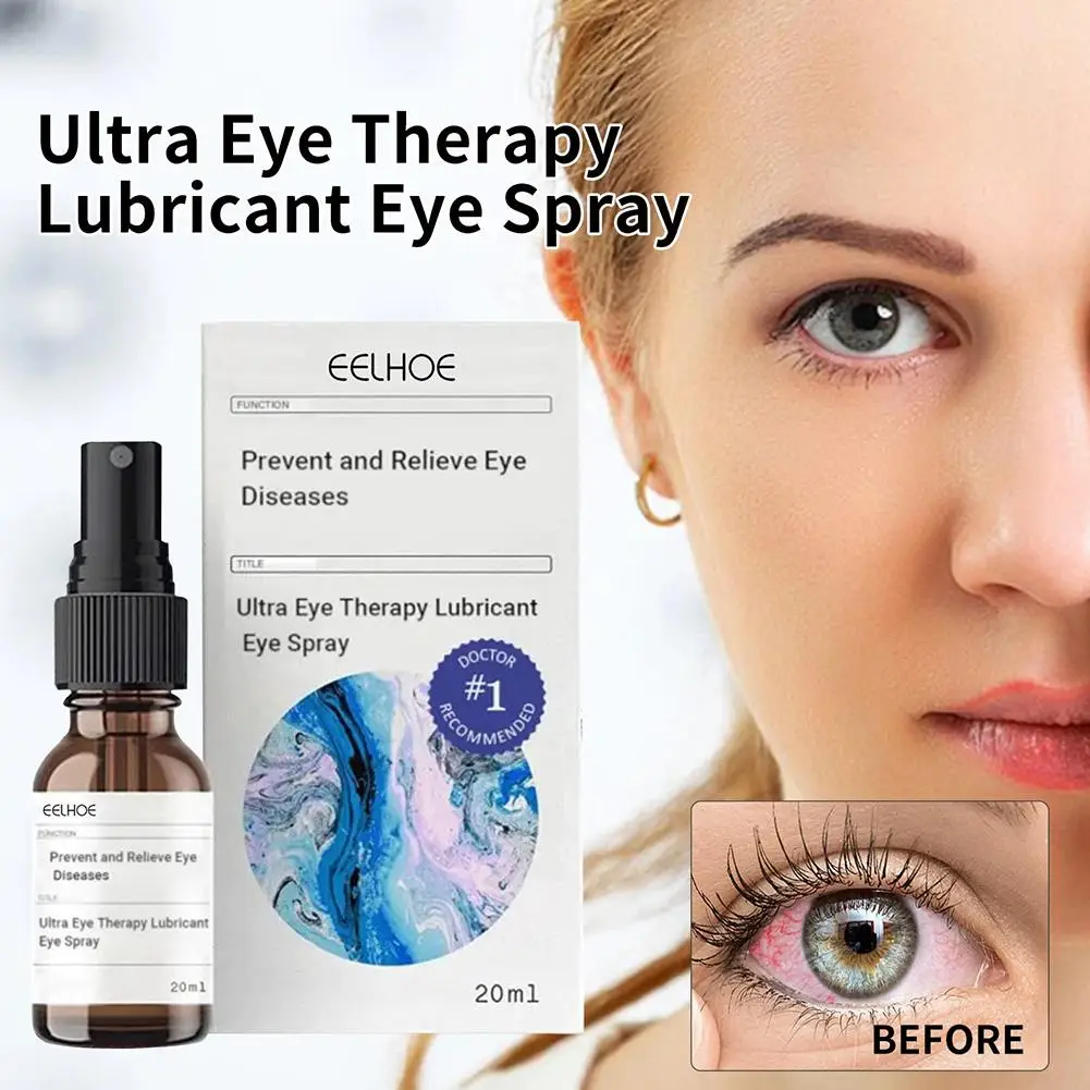 Ultra Eye Therapy Lubricant Eye Spray Prevent And Relieve Dryness Eye Blood Eyes Diseases Streaks Fatigue Eye Remove Red Re H8b8
Ultra Eye Therapy Lubricant Eye Spray Prevent And Relieve Dryness Eye Blood Eyes Diseases Streaks Fatigue Eye Remove Red Re H8b8