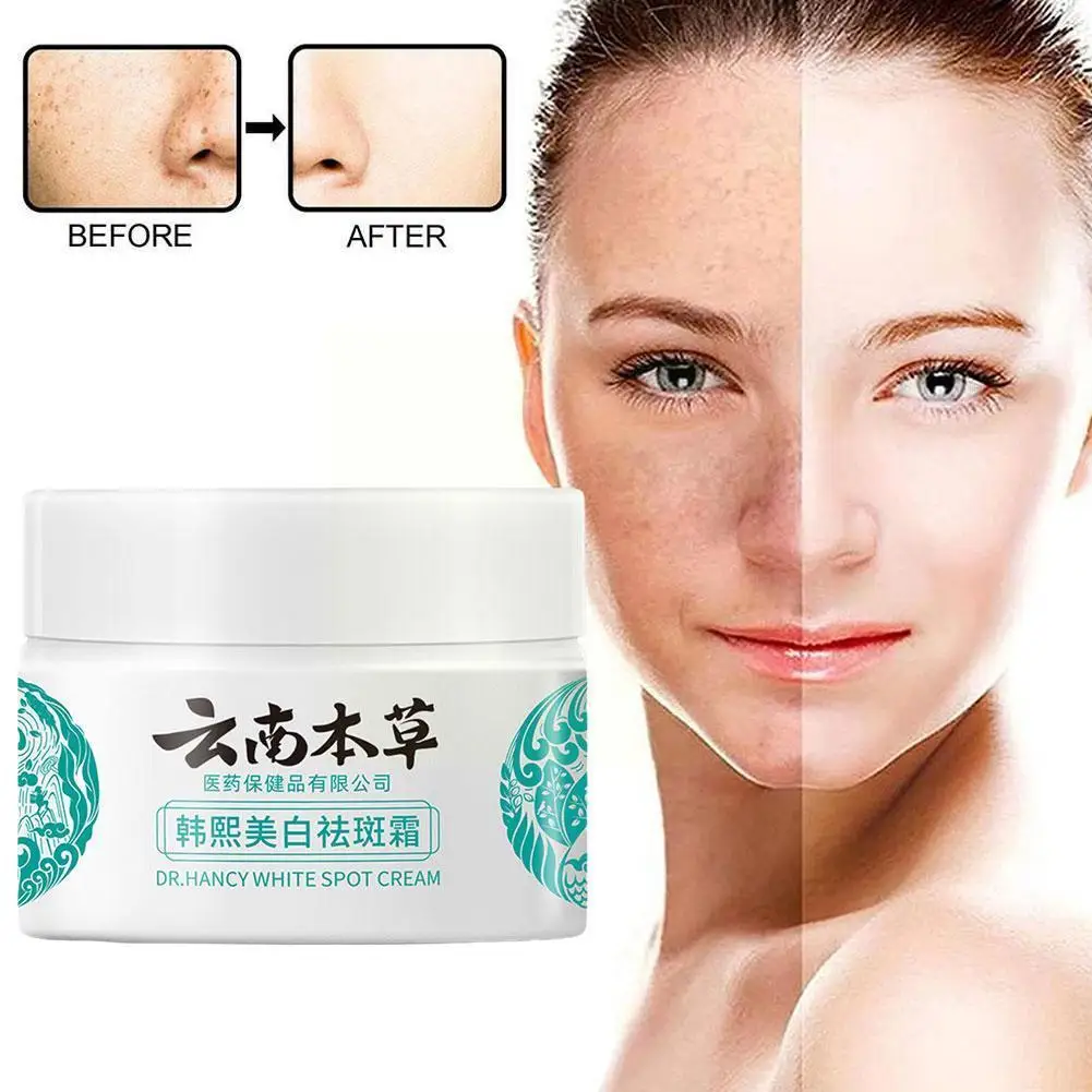 Yunnan Herb Powerful Whitening Freckle Cream Remove Care Dark Acne Face Spots Spots Beauty Moisturizing Face Sk V1K0
Yunnan Herb Powerful Whitening Freckle Cream Remove Care Dark Acne Face Spots Spots Beauty Moisturizing Face Sk V1K0