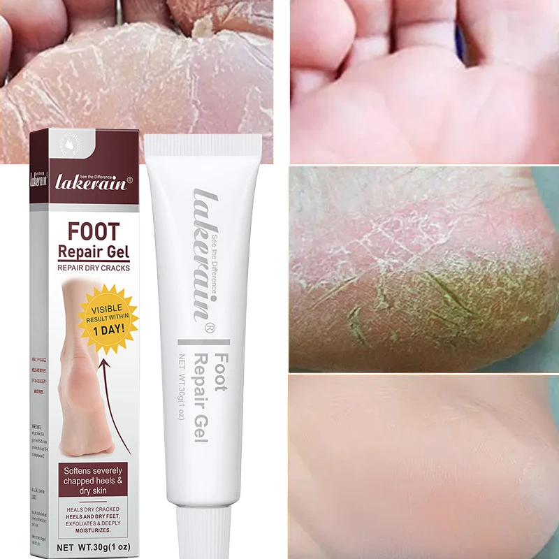 Foot Anti-Cracking Cream Callus Dead Skin Remover Athlete's Foot Treatment Repair For Dry Feet And Crevices Moisturize Foot Care
Foot Anti-Cracking Cream Callus Dead Skin Remover Athlete's Foot Treatment Repair For Dry Feet And Crevices Moisturize Foot Care