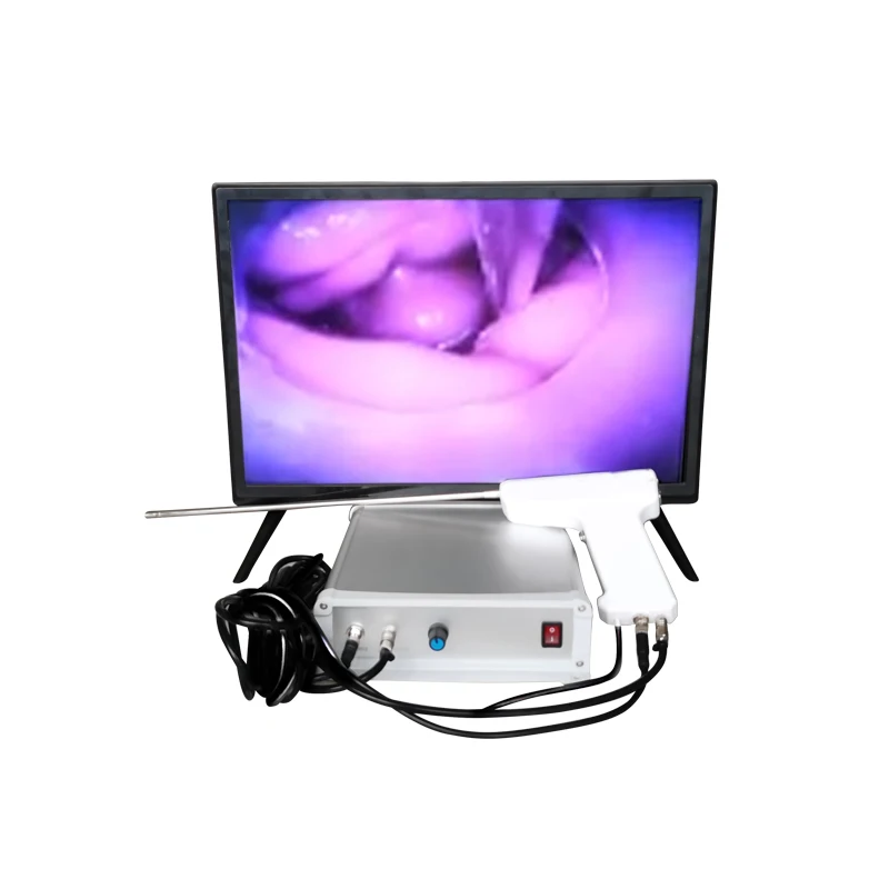RS031 Canine Gevisualiseerd Kunstmatige Inseminatie Systeem/Veterinaire Transcervical Inseminatie Pistool Voor Dieren Ai Kit
RS031 Canine Gevisualiseerd Kunstmatige Inseminatie Systeem/Veterinaire Transcervical Inseminatie Pistool Voor Dieren Ai Kit