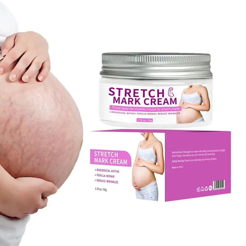 Cream For Stretch Marks 50g Skin Repair And Renewal Cream Skin Moisturizing Pregnancy Cream Stretch Mark Permanent Removal Cream
Cream For Stretch Marks 50g Skin Repair And Renewal Cream Skin Moisturizing Pregnancy Cream Stretch Mark Permanent Removal Cream