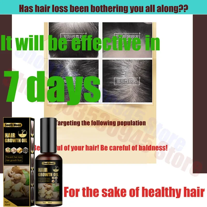 

Fast Hair Growth Serum Oil for Men Women Ginger Anti Hair Loss Scalp Treatment Grow Products Beauty Health Hair Care New
