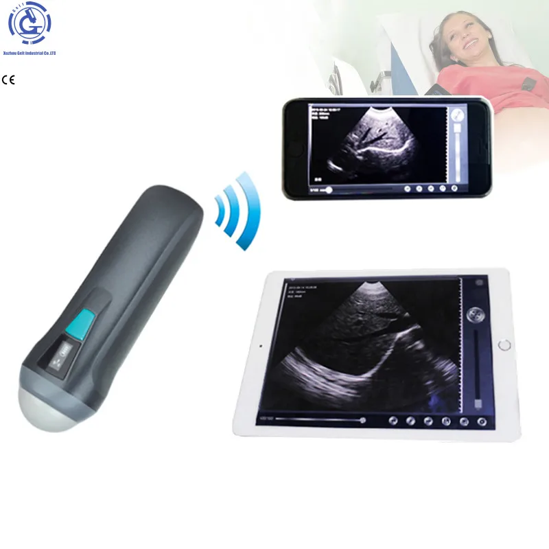 

CE ISO USB wireless wifi convex linear android IOS Mindray ultrasound linear ecograph doppler probe connect with mobile phone