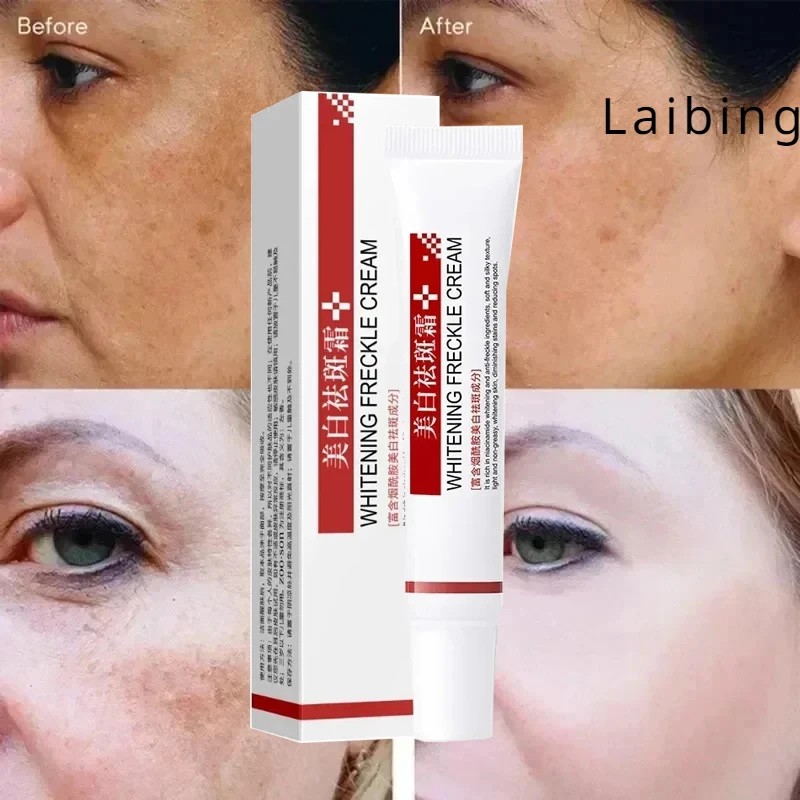 Cleansing Melasma Cream Reduces Melanin and Improves Dry Dull for Women Replenishing Facial Moisture Skin Lifting Care Cream
Cleansing Melasma Cream Reduces Melanin and Improves Dry Dull for Women Replenishing Facial Moisture Skin Lifting Care Cream