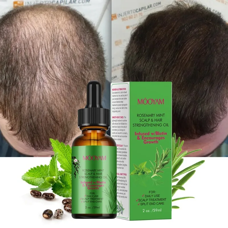Organic Rosemary Mint Scalp & Hair Strengthening Oil With Biotin & Essential Oils,Multipurpose Rosemary Oil
Organic Rosemary Mint Scalp & Hair Strengthening Oil With Biotin & Essential Oils,Multipurpose Rosemary Oil