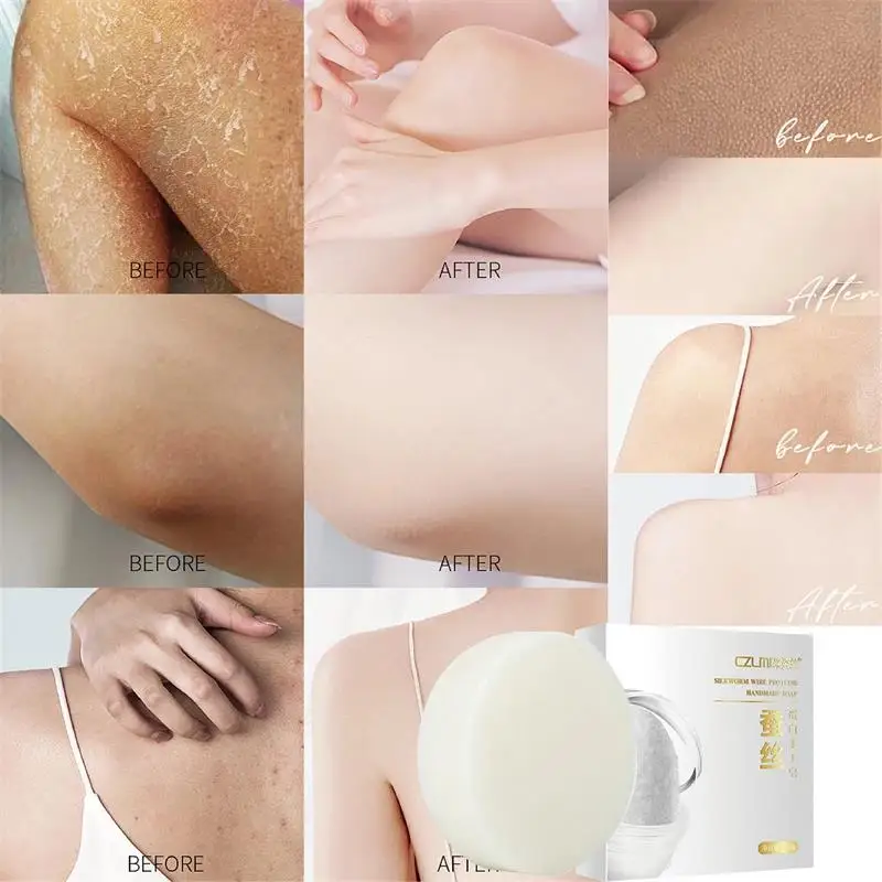 Silkworm Silk Protein Soap Tightens Pores Smooth Skin Underarm Knee Brighten The Complexion Moisturize Skin Body Care Products
Silkworm Silk Protein Soap Tightens Pores Smooth Skin Underarm Knee Brighten The Complexion Moisturize Skin Body Care Products