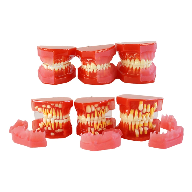 Dental Teeth Model Physician Certification Model Dental Materials Graghically Developing Model Dental Teaching Model Study
Dental Teeth Model Physician Certification Model Dental Materials Graghically Developing Model Dental Teaching Model Study