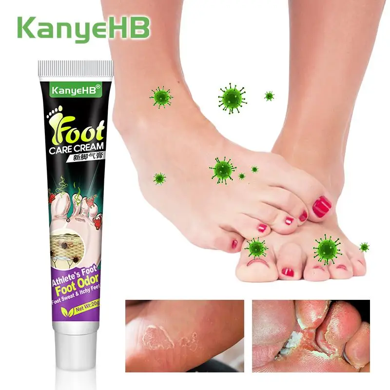 1pcs Antifungal Foot Tinea Cream Toes Skin Erosion Peeling Remove Foot Odor Anti-itch Ointment Tinea Pedis Psoriasis Cream G027
1pcs Antifungal Foot Tinea Cream Toes Skin Erosion Peeling Remove Foot Odor Anti-itch Ointment Tinea Pedis Psoriasis Cream G027