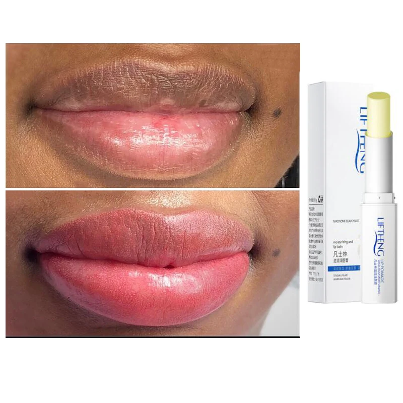 Lip Balm Moisturizer Effective Removal Lip Black Lighten Dark Lip Melanin Moisturizer Scrub Lip Care ,Promotion
Lip Balm Moisturizer Effective Removal Lip Black Lighten Dark Lip Melanin Moisturizer Scrub Lip Care ,Promotion
