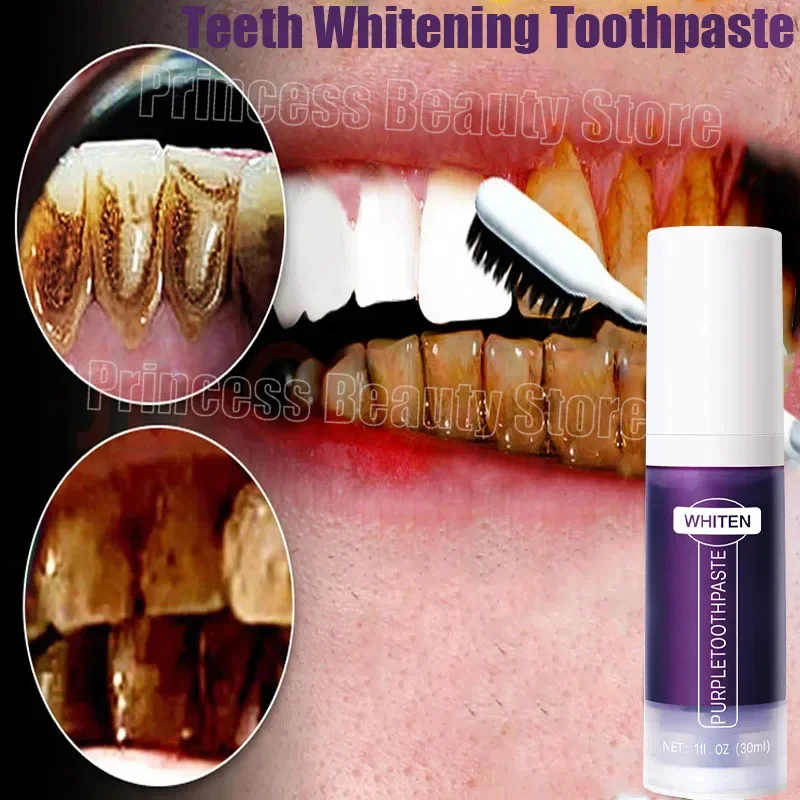 V34 Teeth Whitening Toothpaste 5D Tooth Whitener Strips Oral Hygiene Cleaning Dental Bleaching Tools Fresh Breath Dentistry Care
V34 Teeth Whitening Toothpaste 5D Tooth Whitener Strips Oral Hygiene Cleaning Dental Bleaching Tools Fresh Breath Dentistry Care