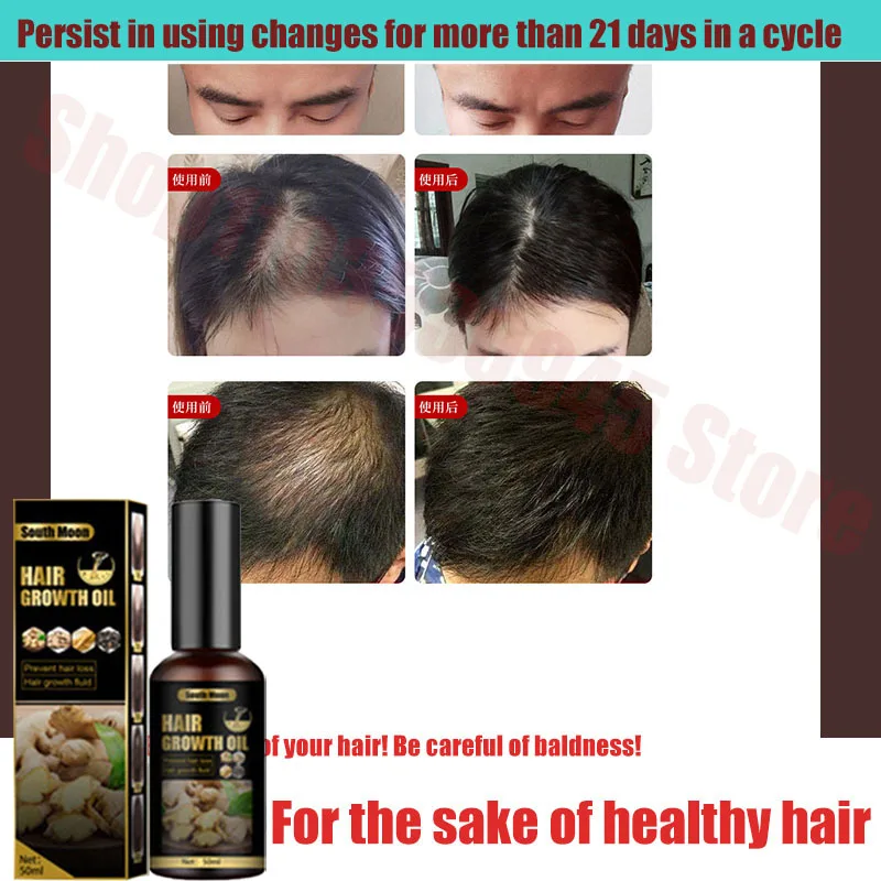 Ginger Hair Growth Spray Products Natural Anti Hair Loss Serum Prevent Baldness Treatment Fast Grows Nourish Damaged Hair Care
Ginger Hair Growth Spray Products Natural Anti Hair Loss Serum Prevent Baldness Treatment Fast Grows Nourish Damaged Hair Care
