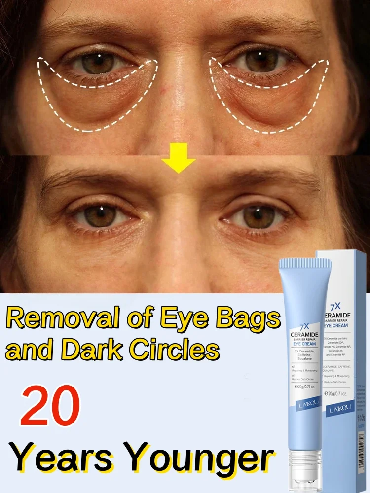 Higher Quality Remove Bags Eyes Cream Fade Dark Circles Fine Line Anti-Aging Firm Lift Whiten Moisturize Pamper Eyes Skin Care
Higher Quality Remove Bags Eyes Cream Fade Dark Circles Fine Line Anti-Aging Firm Lift Whiten Moisturize Pamper Eyes Skin Care