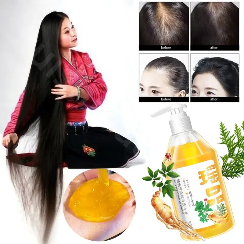

Травяной шампунь Yao Pin против зачистки, улучшающий выпадение волос, против перхоти, против зуда и совместимый контроль жирности