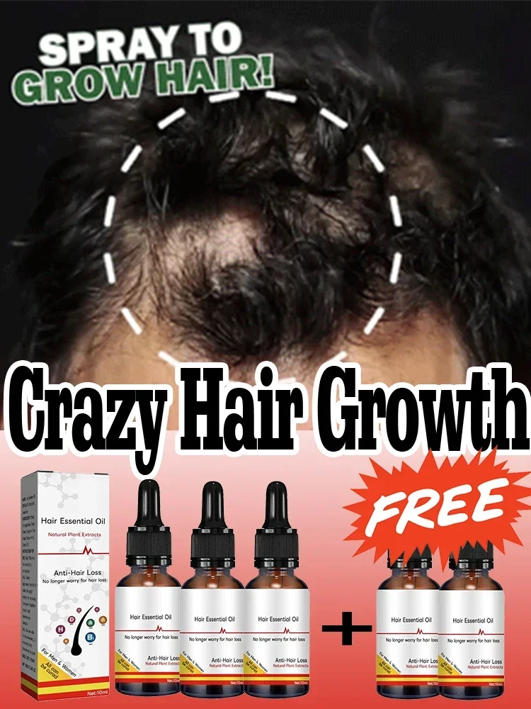 Biotin Hair Growth Products for Man Women Anti Hair Loss Ginger Serum Fast Regrowth Oil
Biotin Hair Growth Products for Man Women Anti Hair Loss Ginger Serum Fast Regrowth Oil