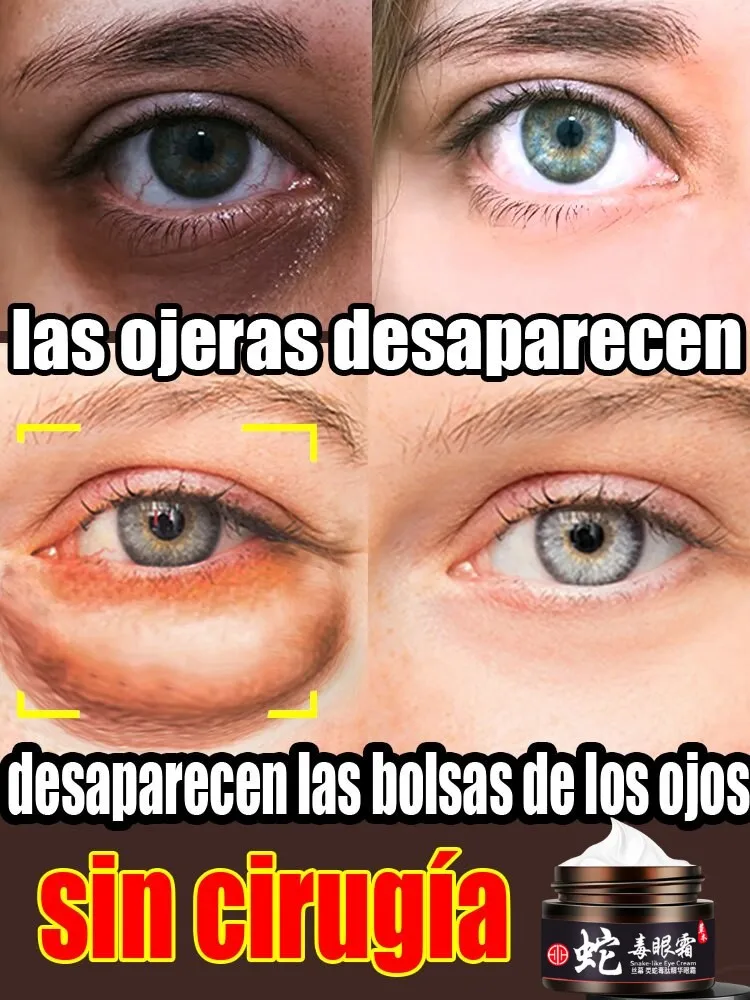 Wrinkle Remove Eye Cream Snake Venom Desalinating Bags Fat Granules Firming Skin Snake Venom Peptide Modified Eye Care Serum
Wrinkle Remove Eye Cream Snake Venom Desalinating Bags Fat Granules Firming Skin Snake Venom Peptide Modified Eye Care Serum