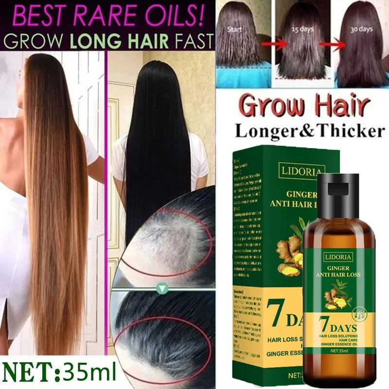 10Bottle Ginger Hair Growth Product Anti Hair Loss Serum Liquid Fast Grow Prevent Baldness for Men Women Hair Care Essential Oil
10Bottle Ginger Hair Growth Product Anti Hair Loss Serum Liquid Fast Grow Prevent Baldness for Men Women Hair Care Essential Oil