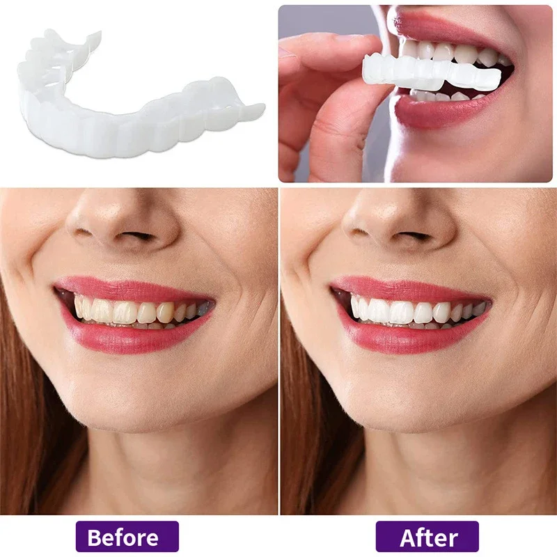 

Sdotter New Perfect Fit Teeth Whitening Fake Tooth Cover Snap On Silicone Smile Veneers Teeth Upper Beauty Tool Cosmetic Teeth H