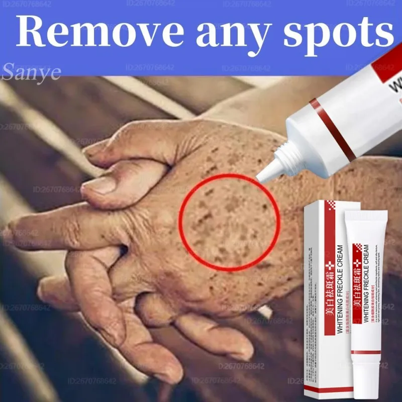 Face Melasma Cream Brightening Dark Skin Emulsion Lightening Melanin Brighten Cream For Dull Skin Women Moisturizing Products
Face Melasma Cream Brightening Dark Skin Emulsion Lightening Melanin Brighten Cream For Dull Skin Women Moisturizing Products