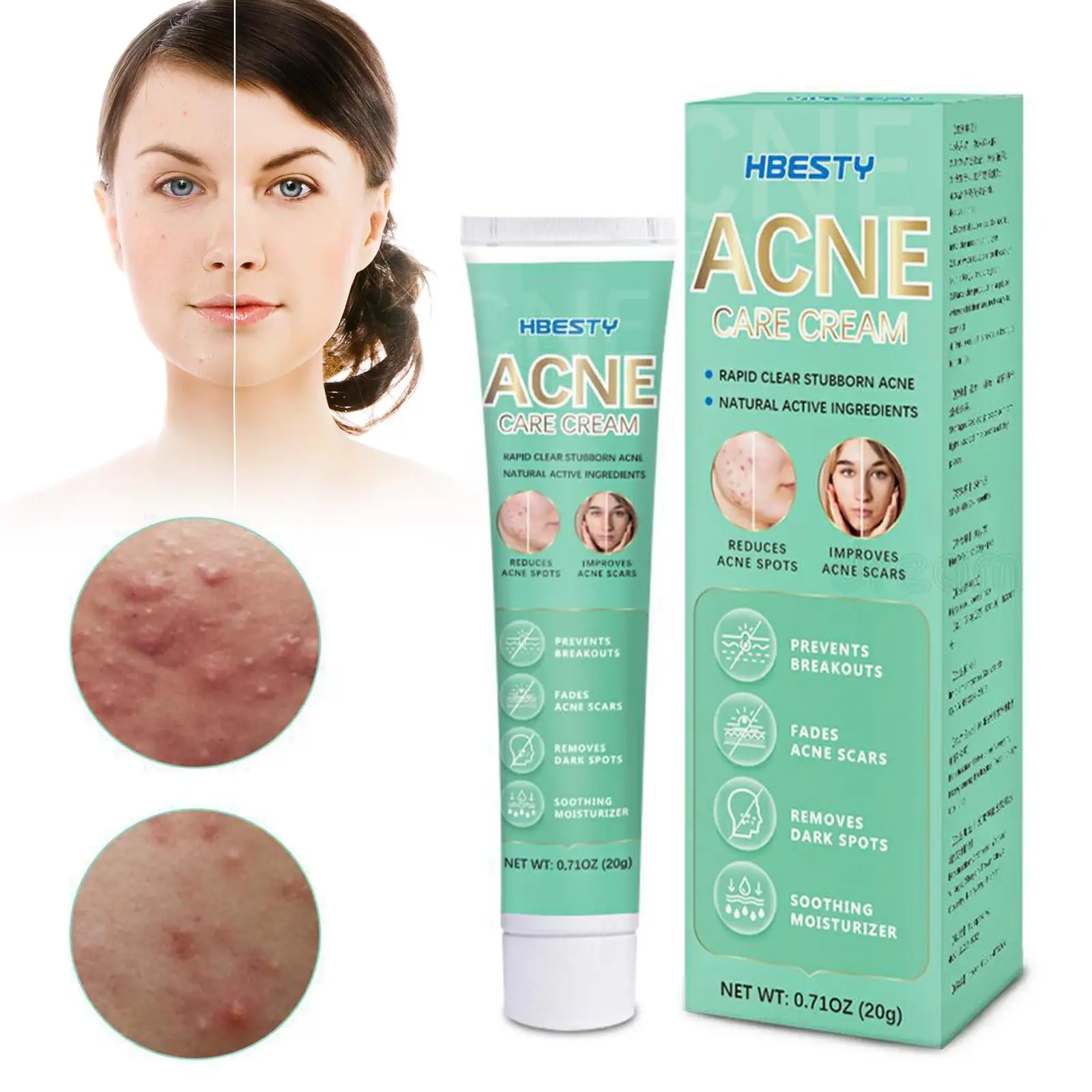 20g Acne Gel Acne Oil Control Anti Acne Anti Inflammation Irritating Facial And Soothing Gel Mild Essence Care Non N8Y8
20g Acne Gel Acne Oil Control Anti Acne Anti Inflammation Irritating Facial And Soothing Gel Mild Essence Care Non N8Y8