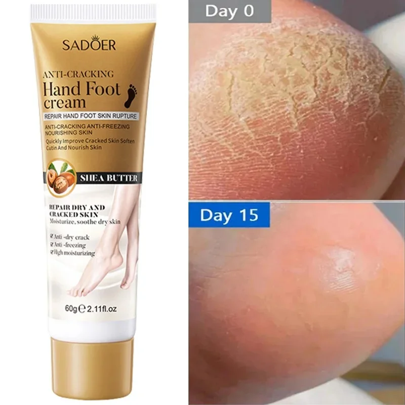 

Anti Crack Hand Foot Cream Anti-Drying Heel Cracked Repair Feet Mask Removal Dead Skin Moisturizing Whitening Feet Care Products