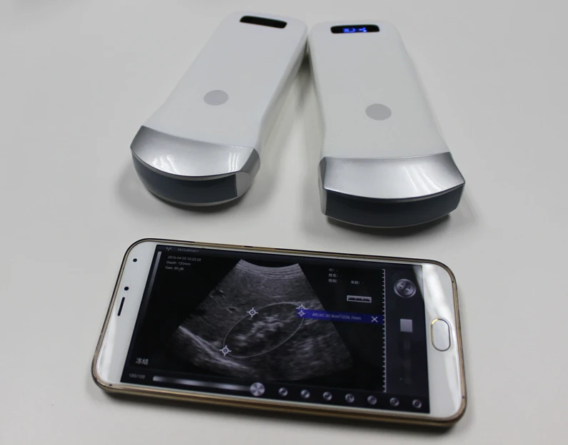 SY-AU02C ultrasonic ultrasound wireless convex array probe scanner transducer
SY-AU02C ultrasonic ultrasound wireless convex array probe scanner transducer