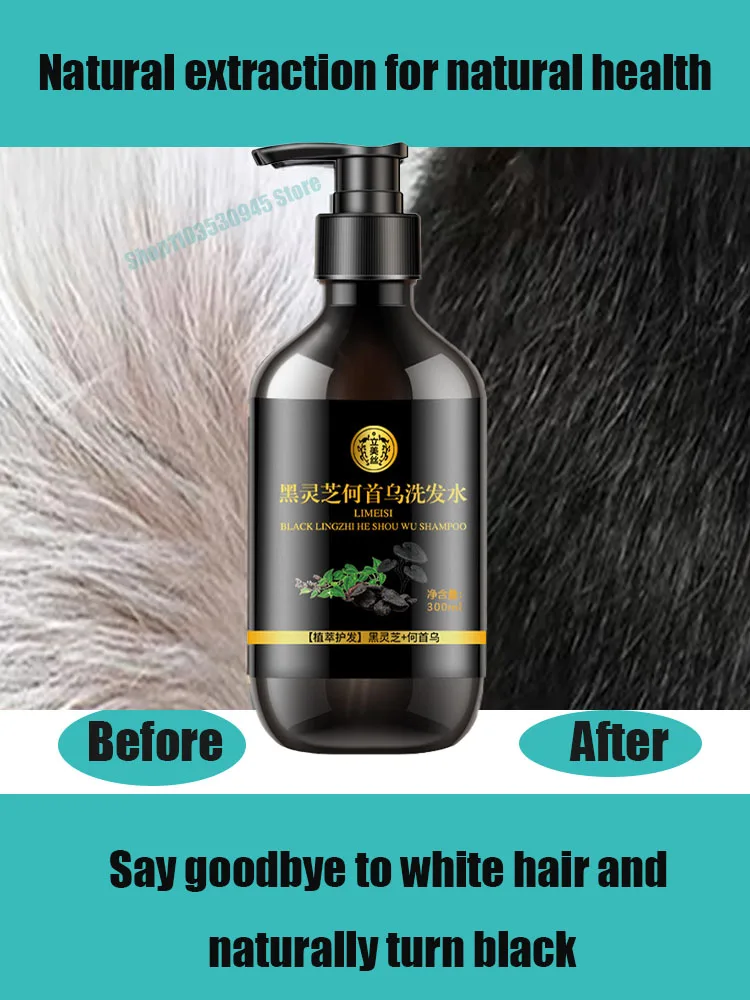 

Polygonum Multiflorum White To Black Shampoo Herbal Polygonum Shampoo Effective Grey Hair Remover Anti White Hair Treatmen
