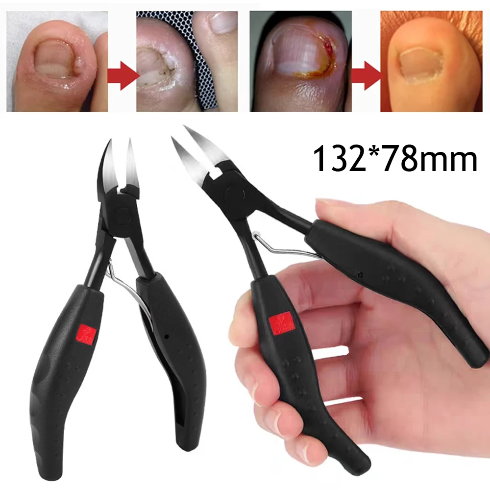 

Practical Paronychia Clippers Nail Ingrown Nipper Professional Toenail Cutter Dead Skin Remover Cuticle Scissors Pedicure Tools