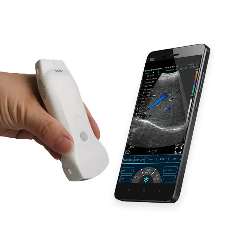 

Products subject to negotiationHigh Quality Elements Wireless Color Doppler Ultrasound Convex Probe for IOS Android Windows