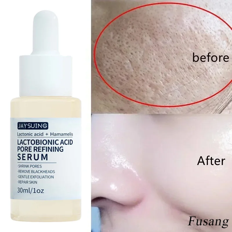 

Whitening Tighten Pore Serum Women Face Shrink Pores Essence Efficient Remove Acne Blackhead Essence Korean Smooth Skin Care