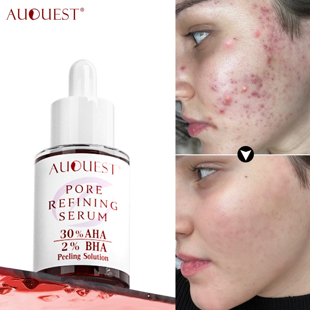 

Acne Treatment Facial Serum Pore Shrinking Skin Care Against Face Acne Pimple Spots Remover Cleaning Salicylic Acid Serum 40ml