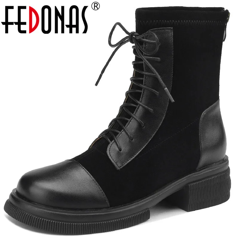 FEDONAS Vintage Women Ankle Boots Low Heels Casual Working Genuine Leather Cross-Tied Autumn Winter Back Zipper Shoes Woman 2023
FEDONAS Vintage Women Ankle Boots Low Heels Casual Working Genuine Leather Cross-Tied Autumn Winter Back Zipper Shoes Woman 2023
