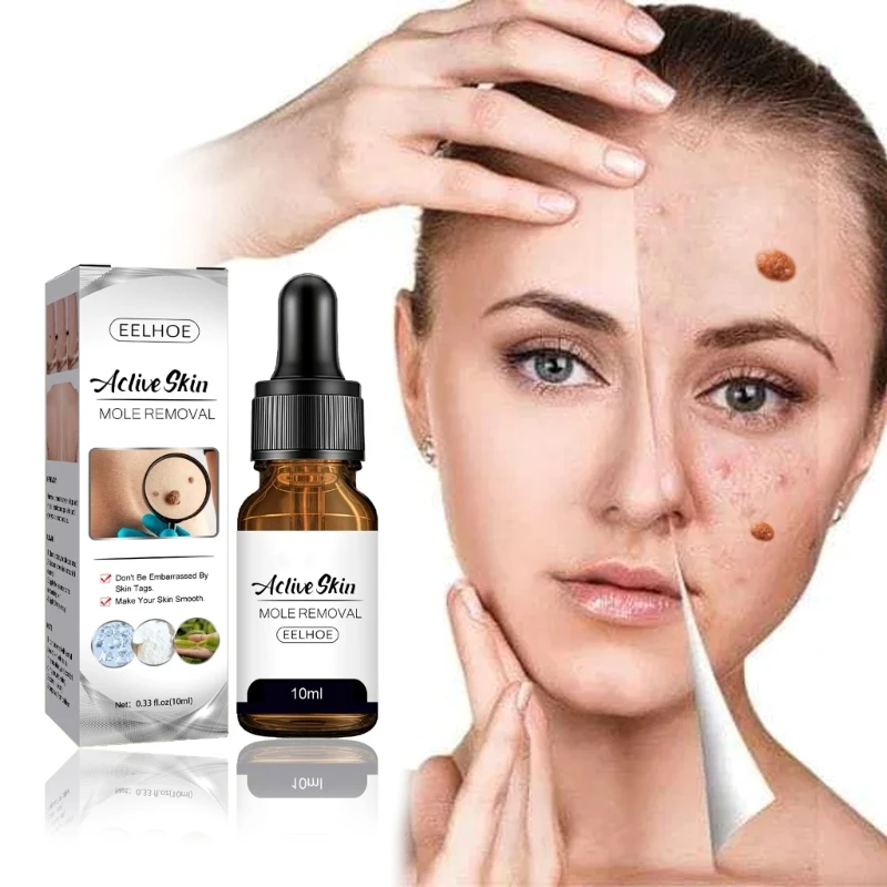 Skin Tags Flat Wart Painless Remove Mole Dark Spots Beauty Health-Products 10ml Drop Shipping
Skin Tags Flat Wart Painless Remove Mole Dark Spots Beauty Health-Products 10ml Drop Shipping