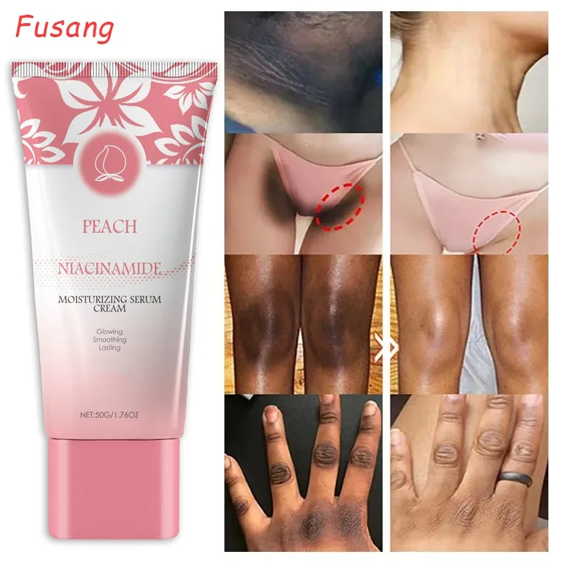 Dark Skin Knuckles Brightening Cream Niacinamide Powerful Body Lightening Emulsion Women Facial Brighten Cream Korean Skin Care
Dark Skin Knuckles Brightening Cream Niacinamide Powerful Body Lightening Emulsion Women Facial Brighten Cream Korean Skin Care