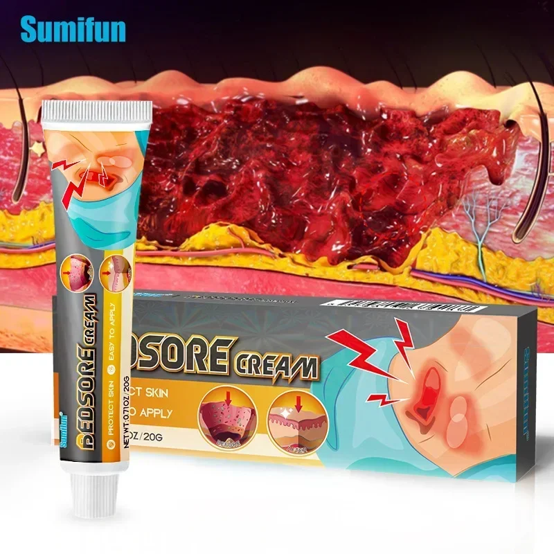 SdatterBedsore Treatment Cream Pressure Sore Ulcer Skin Rot Necrotic repair Relief Ointment Bed Sore Wound Healing Decubitus Fee
SdatterBedsore Treatment Cream Pressure Sore Ulcer Skin Rot Necrotic repair Relief Ointment Bed Sore Wound Healing Decubitus Fee