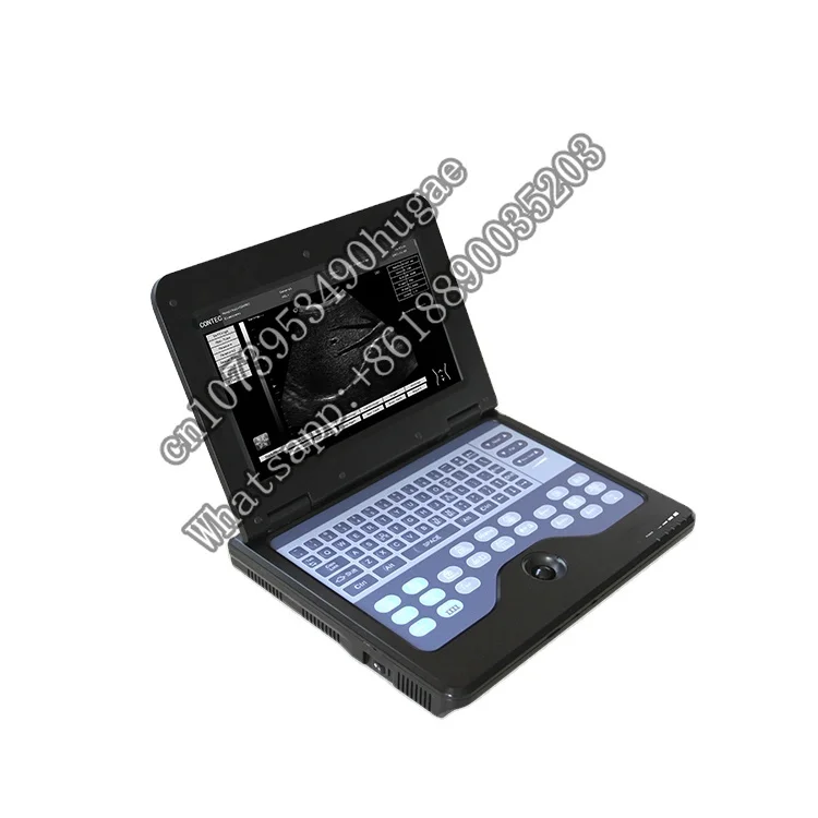 CONTEC CMS600P2-VET clinic, ветеринарные инструменты, ультразвуковое оборудование, Китай
CONTEC CMS600P2-VET clinic, ветеринарные инструменты, ультразвуковое оборудование, Китай