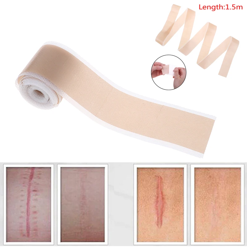 

4x150cm Efficient Surgery Scar Removal Silicone Gel Sheet Therapy Patch for Acne Trauma Burn Scar Skin Repair Scar Treatment